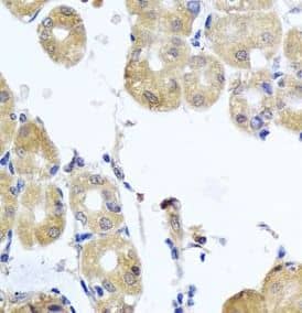Immunohistochemistry: RhoB Antibody - BSA Free [NBP3-46738] - Immunohistochemistry of paraffin-embedded human stomach tissue slide using ( RhoB Antibody) at dilution of 1:50