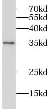 Western Blot RHBDL2 Antibody - BSA Free