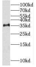 Western Blot: RHBDD1 Antibody - BSA Free [NBP3-46740] - Mouse kidney tissue were subjected to SDS PAGE followed by western blot with (RHBDD1 antibody) at dilution of 1:3000