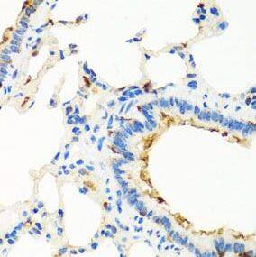 Immunohistochemistry: RGS5 Antibody - BSA Free [NBP3-46744] - Immunohistochemistry of paraffin-embedded human liver using (RGS5 antibody) at dilution of 1:100