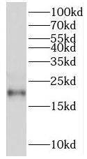 Western Blot: RGS10 Antibody - BSA Free [NBP3-46749] - Mouse thymus tissue were subjected to SDS PAGE followed by western blot with (RGS10 antibody) at dilution of 1:600