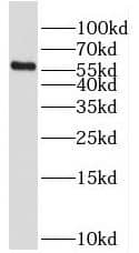 Western Blot RFTN2 Antibody - BSA Free