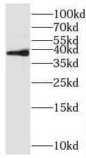 Western Blot: Rffl Antibody - BSA Free [NBP3-46753] - Mouse testis tissue were subjected to SDS PAGE followed by western blot with (Rffl antibody) at dilution of 1:500