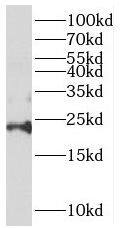 Western Blot: REEP6 Antibody - BSA Free [NBP3-46759] - BxPC-3 cells were subjected to SDS PAGE followed by western blot with (REEP6 antibody) at dilution of 1:400