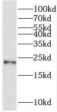Western Blot: REEP1 Antibody - BSA Free [NBP3-46760] - Rat brain tissue were subjected to SDS PAGE followed by western blot with (REEP1 antibody) at dilution of 1:500
