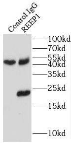 Immunoprecipitation: REEP1 Antibody - BSA Free [NBP3-46760] - IP Result of anti-REEP1 (IP:, 3ug; Detection: 1:500) with mouse brain tissue lysate 4000ug.