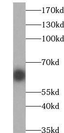 Western Blot: RECQL5 Antibody - BSA Free [NBP3-46761] - Mouse testis tissue were subjected to SDS PAGE followed by western blot with (RECQL5 antibody) at dilution of 1:1000