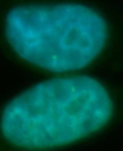 Immunocytochemistry/ Immunofluorescence: RECQL5 Antibody - BSA Free [NBP3-46761] - Immunofluorescent analysis of HepG2 cells, using RECQL5 antibody  at 1:100 dilution and FITC-labeled donkey anti-rabbit IgG(green). Blue pseudocolor = DAPI (fluorescent DNA dye).