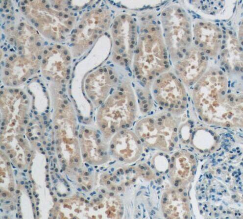 Immunohistochemistry: RECQL4 Antibody - BSA Free [NBP3-46762] - Immunohistochemistry of paraffin-embedded human kidney tissue slide using (RECQL4 Antibody) at dilution of 1:50