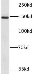 Western Blot: RECQL4 Antibody - BSA Free [NBP3-46762] - HeLa cells were subjected to SDS PAGE followed by western blot with (RECQL4 antibody) at dilution of 1:1000