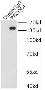 Immunoprecipitation: RECQL4 Antibody - BSA Free [NBP3-46762] - IP Result of anti-RECQL4 (IP:, 4ug; Detection: 1:1000) with HeLa cells lysate 2500ug.