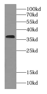 Western Blot: RDH14 Antibody - BSA Free [NBP3-46764] - Human heart tissue were subjected to SDS PAGE followed by western blot with (RDH14 antibody) at dilution of 1:200