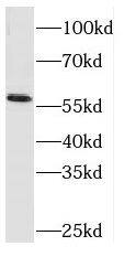 Western Blot: RCOR2 Antibody - BSA Free [NBP3-46768] - Jurkat cells were subjected to SDS PAGE followed by western blot with ( RCOR2 Antibody) at dilution of 1:1000