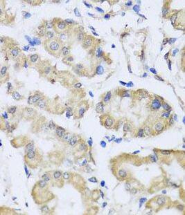 Immunohistochemistry RCN2 Antibody - BSA Free