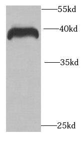 Western Blot: RCN2 Antibody - BSA Free [NBP3-46769] - Human brain tissue were subjected to SDS PAGE followed by western blot with (RCN2 antibody) at dilution of 1:1000