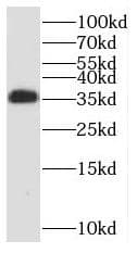 Western Blot RCBTB1 Antibody - BSA Free