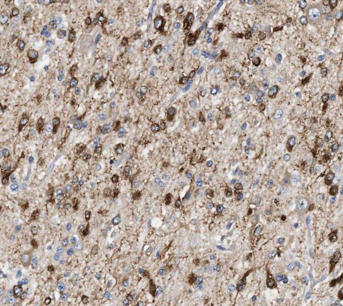 Immunohistochemistry RCAN2 Antibody - BSA Free