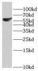Western Blot: RBPSUHL Antibody - BSA Free [NBP3-46773] - Jurkat cells were subjected to SDS PAGE followed by western blot with ( RBPSUHL Antibody) at dilution of 1:1500