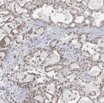 Immunohistochemistry RBM6 Antibody - BSA Free