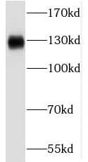 Western Blot: RBM6 Antibody - BSA Free [NBP3-46777] - HeLa cells were subjected to SDS PAGE followed by western blot with (RBM6 antibody) at dilution of 1:300