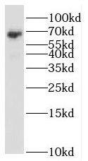 Western Blot: RBM47 Antibody - BSA Free [NBP3-46779] - A549 cells were subjected to SDS PAGE followed by western blot with ( RBM47 Antibody) at dilution of 1:1000