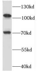 Western Blot: RBM15B Antibody - BSA Free [NBP3-46783] - HeLa cells were subjected to SDS PAGE followed by western blot with (RBM15B antibody) at dilution of 1:2000