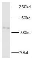 Western Blot: RBM10 Antibody - BSA Free [NBP3-46785] - Human brain tissue were subjected to SDS PAGE followed by western blot with (RBM10 antibody) at dilution of 1:1000