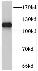 Western Blot: RAIN Antibody - BSA Free [NBP3-46788] - Mouse lung tissue were subjected to SDS PAGE followed by western blot with (RAIN Antibody) at dilution of 1:300