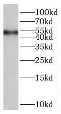 Western Blot: RASGRP2 Antibody - BSA Free [NBP3-46789] - Mouse kidney tissue were subjected to SDS PAGE followed by western blot with (RASGRP2 antibody) at dilution of 1:300
