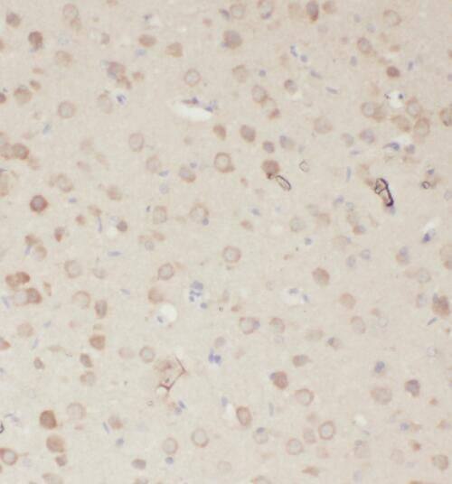 Immunohistochemistry: RASGEF1A Antibody - BSA Free [NBP3-46791] - Immunohistochemistry of paraffin-embedded human brain using (RASGEF1A antibody) at dilution of 1:100