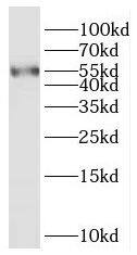 Western Blot RASGEF1A Antibody - BSA Free