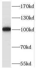 Western Blot: RASA3 Antibody - BSA Free [NBP3-46793] - HeLa cells were subjected to SDS PAGE followed by western blot with (RASA3 antibody) at dilution of 1:500