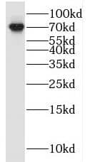 Western Blot: RAPGEF5 Antibody - BSA Free [NBP3-46797] - Human brain tissue were subjected to SDS PAGE followed by western blot with (RAPGEF5 antibody) at dilution of 1:500