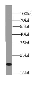 Western Blot: MOG1 Antibody - BSA Free [NBP3-46801] - SGC-7901 cells were subjected to SDS PAGE followed by western blot with (MOG1 antibody) at dilution of 1:1000