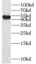 Western Blot: RANBP3L Antibody - BSA Free [NBP3-46803] - Jurkat cells were subjected to SDS PAGE followed by western blot with (RANBP3L antibody) at dilution of 1:1000