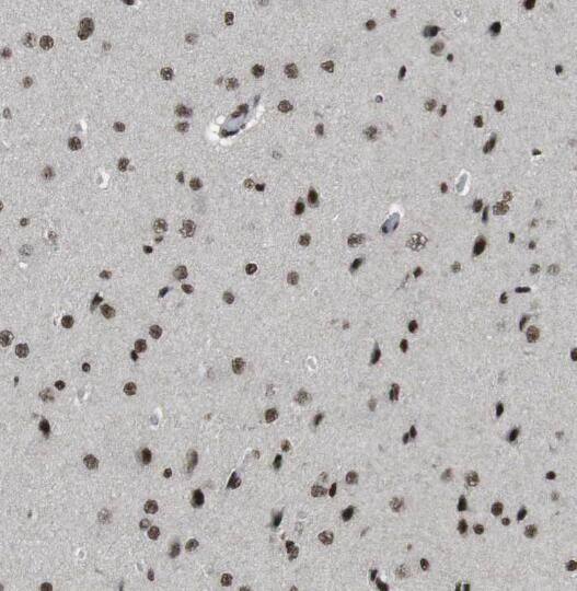 Immunohistochemistry: RANBP3L Antibody - BSA Free [NBP3-46803] - Immunohistochemistry of paraffin-embedded human brain using (RANBP3L antibody) at dilution of 1:100