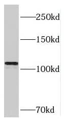 Western Blot: RAI14 Antibody - BSA Free [NBP3-46806] - HeLa cells were subjected to SDS PAGE followed by western blot with (RAI14 antibody) at dilution of 1:400