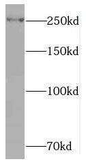 Western Blot: RAI1 Antibody - BSA Free [NBP3-46807] - HeLa cells were subjected to SDS PAGE followed by western blot with (RAI1 antibody) at dilution of 1:500