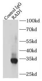 Immunoprecipitation: Rad1 Antibody - BSA Free [NBP3-46809] - IP Result of anti-Rad1 (IP:, 3ug; Detection: 1:300) with HeLa cells lysate 3200ug.