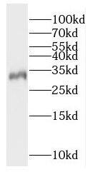 Western Blot Rad1 Antibody - BSA Free