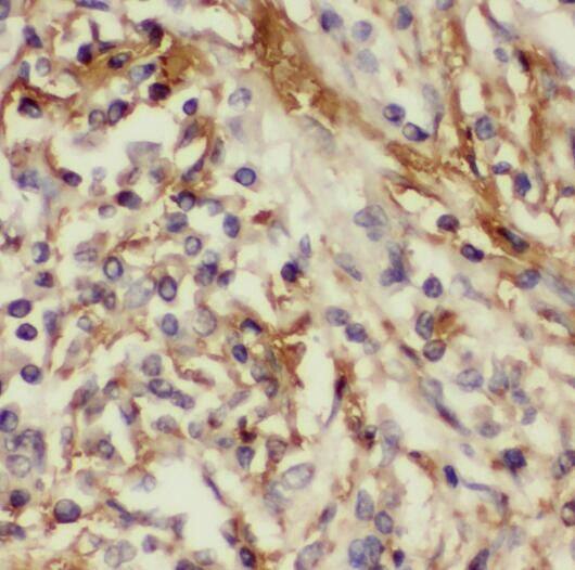 Immunohistochemistry RABL2B Antibody - BSA Free