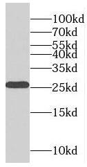 Western Blot: RABL2B Antibody - BSA Free [NBP3-46811] - Human brain tissue were subjected to SDS PAGE followed by western blot with (RABL2B antibody) at dilution of 1:500