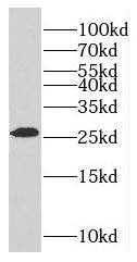 Western Blot: RABL2A Antibody - BSA Free [NBP3-46812] - Mouse pancreas tissue were subjected to SDS PAGE followed by western blot with (RABL2A antibody) at dilution of 1:300