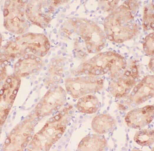 Immunohistochemistry RABL2A Antibody - BSA Free