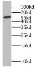 Western Blot: Rabex5 Antibody - BSA Free [NBP3-46813] - PC-3 cells were subjected to SDS PAGE followed by western blot with (Rabex5 antibody) at dilution of 1:300