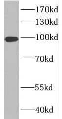 Western Blot RABGAP1L Antibody - BSA Free