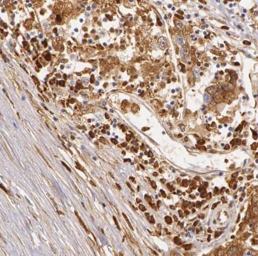 Immunohistochemistry RABGAP1L Antibody - BSA Free