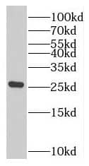 Western Blot: RAB7B Antibody - BSA Free [NBP3-46816] - Human heart tissue were subjected to SDS PAGE followed by western blot with (RAB7B antibody) at dilution of 1:200