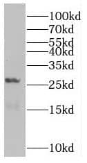 Western Blot: Rab5b Antibody - BSA Free [NBP3-46817] - Mouse lung tissue were subjected to SDS PAGE followed by western blot with (Rab5b antibody) at dilution of 1:1000