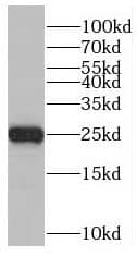 Western Blot RAB41 Antibody - BSA Free